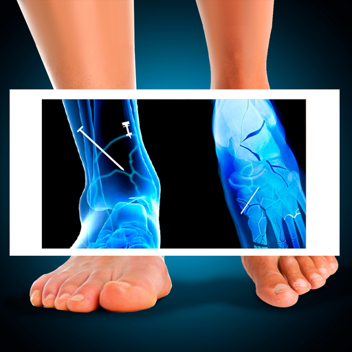 Xray Fracture Foot Prank app icon