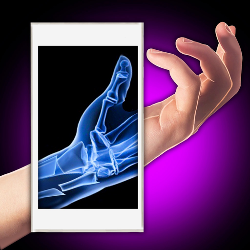 Xray Fracture Hand Prank app icon