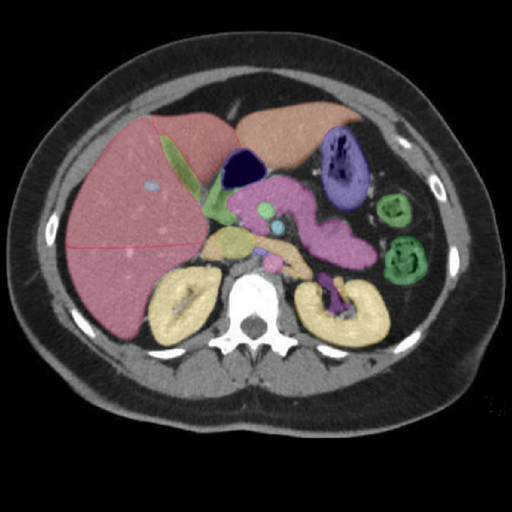 Radiology CT Viewer app icon