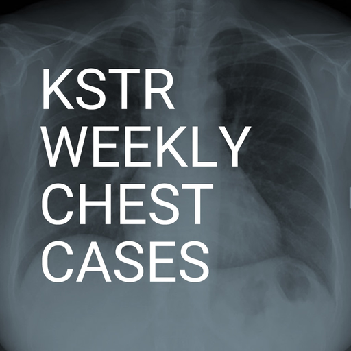 KSTR Weekly Chest Cases app icon