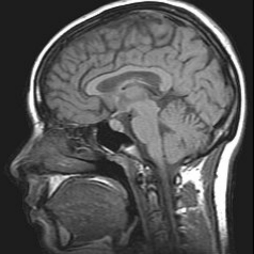 MRI Viewer app icon
