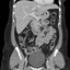 CT Abdomen Pelvis icon