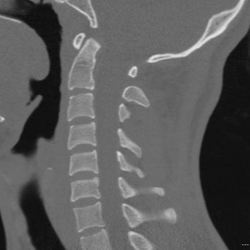 CT Cervical Spine app icon