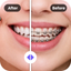 Braces AI Photo Editor icon