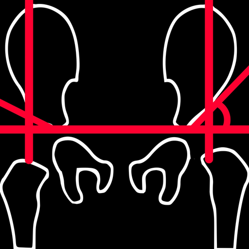 AcetabularIndex app icon