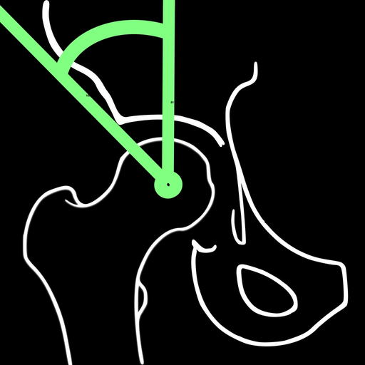 CenterEdgeAngleApp app icon