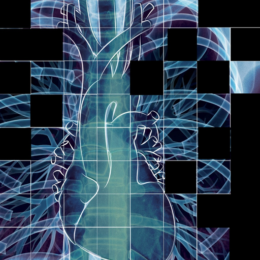 Chest X-ray Interpretation app icon