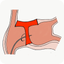TRANSEPTAID icon