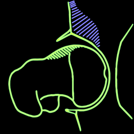 FemoroAcetabularImpingementApp app icon