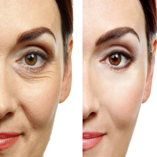 Face Wrinkles app icon