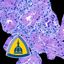 Renal Transplant Pathology icon