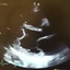 Echo exam quiz icon