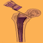 FemurOsteotomyTHR icon