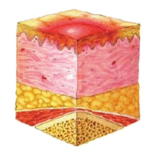 BCG Pressure Ulcer Guide app icon