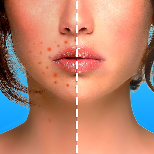 Blemish Editor - Face Tuner app icon