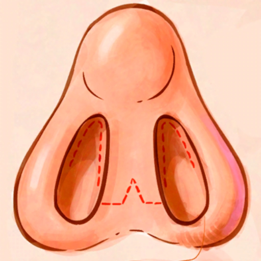 IPO Rinoplastia RA app icon