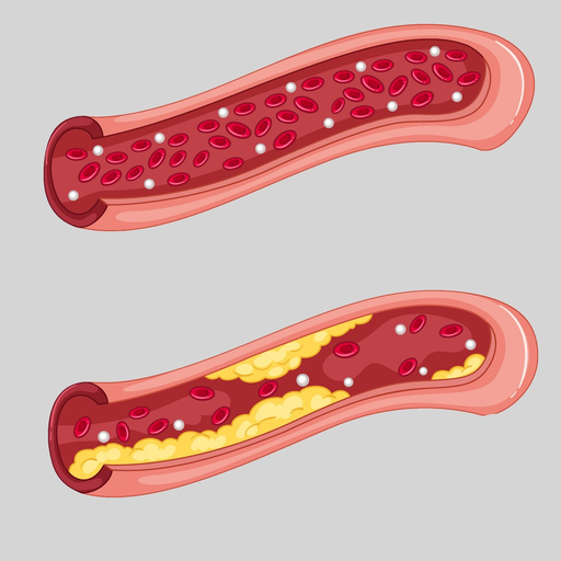 Peripheral Vascular Disease app icon