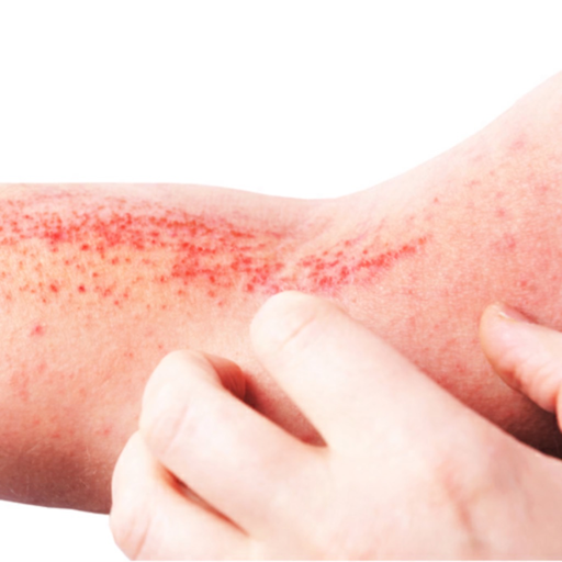 Managing Atopic Dermatitis app icon