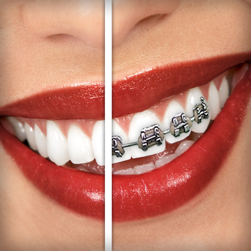 Brace Face app icon