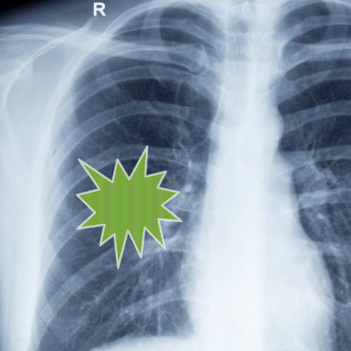 Pneumonia Guide app icon