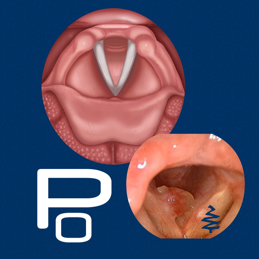 Vocal Pathology: Polyps app icon