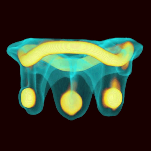 Valve In Valve (Mitral) app icon