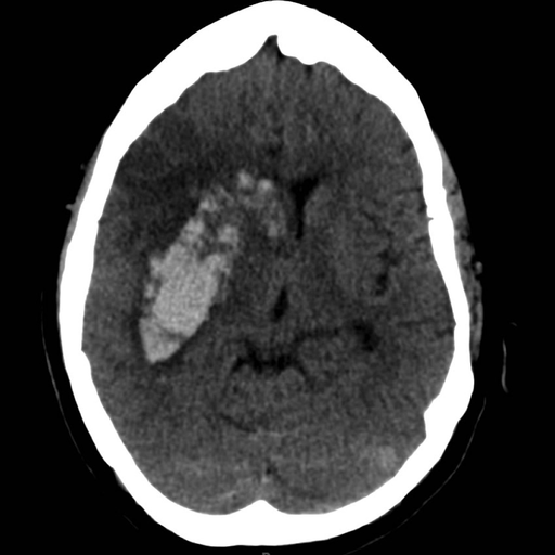 HeRS - Hemorrhage Risk Stratification Calculator app icon