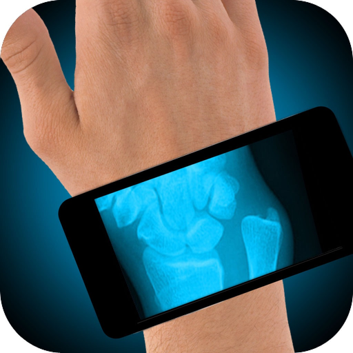 Simulator X-Ray Hand Fracture app icon